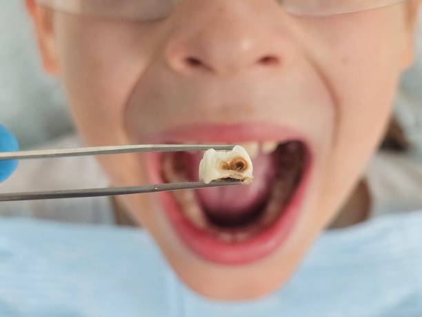 Best Emergency Care for Gum Disease in Tsaile, AZ